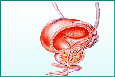 L'inflammation de la prostate dans la prostatite aiguë représente une restriction pendant les rapports sexuels